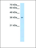 Anti-OTC antibody produced in rabbit IgG fraction of antiserum