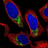 Anti-GRK6 antibody produced in rabbit Prestige Antibodies&#174; Powered by Atlas Antibodies, affinity isolated antibody, buffered aqueous glycerol solution