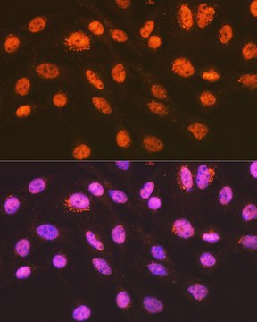 Anti-ENT2/SLC29A2 Antibody, clone 7B2J3, Rabbit Monoclonal