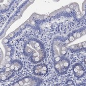 Anti-MYL1 antibody produced in rabbit Prestige Antibodies&#174; Powered by Atlas Antibodies, affinity isolated antibody, buffered aqueous glycerol solution