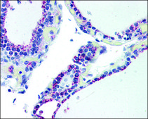 Anti-ADORA2B antibody produced in rabbit affinity isolated antibody