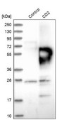 Anti-CD2 antibody produced in rabbit Prestige Antibodies&#174; Powered by Atlas Antibodies, affinity isolated antibody, buffered aqueous glycerol solution