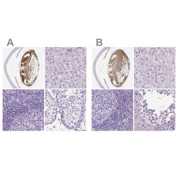 Anti-LGSN antibody produced in rabbit Prestige Antibodies&#174; Powered by Atlas Antibodies, affinity isolated antibody