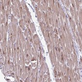 Anti-AKAP6 antibody produced in rabbit Prestige Antibodies&#174; Powered by Atlas Antibodies, affinity isolated antibody, buffered aqueous glycerol solution