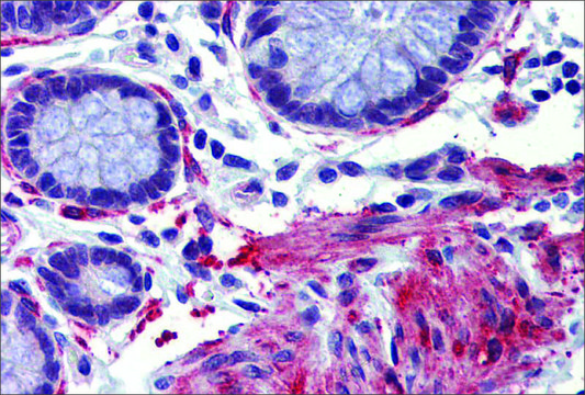 Anti-CREBBP antibody produced in rabbit affinity isolated antibody