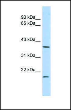 Anti-MTHFD2L antibody produced in rabbit affinity isolated antibody