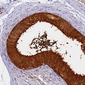 Anti-WFDC2 antibody produced in rabbit Prestige Antibodies&#174; Powered by Atlas Antibodies, affinity isolated antibody, buffered aqueous glycerol solution