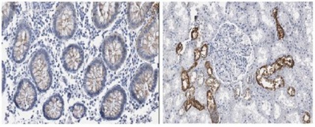 Anti-INK4a (p16) Antibody, clone 13H4.1 clone 13H4.1, from mouse