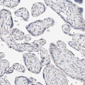Anti-FDPS antibody produced in rabbit Prestige Antibodies&#174; Powered by Atlas Antibodies, affinity isolated antibody, buffered aqueous glycerol solution