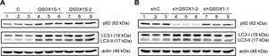 Anti-LC3 antibody produced in rabbit ~1&#160;mg/mL, affinity isolated antibody, buffered aqueous solution