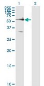 Monoclonal Anti-FZD5 antibody produced in mouse clone 6A3, purified immunoglobulin, buffered aqueous solution