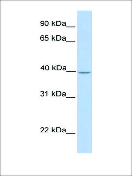 Anti-SAMSN1 antibody produced in rabbit affinity isolated antibody