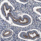 Anti-CHST10 antibody produced in rabbit Prestige Antibodies&#174; Powered by Atlas Antibodies, affinity isolated antibody, buffered aqueous glycerol solution