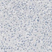 Anti-SPINK4 antibody produced in rabbit Prestige Antibodies&#174; Powered by Atlas Antibodies, affinity isolated antibody, buffered aqueous glycerol solution