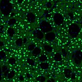 Anti-BCL11B antibody produced in rabbit Prestige Antibodies&#174; Powered by Atlas Antibodies, affinity isolated antibody, buffered aqueous glycerol solution