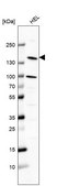 Anti-PLCB2 antibody produced in rabbit Prestige Antibodies&#174; Powered by Atlas Antibodies, affinity isolated antibody