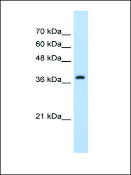 Anti-CBX6 (AB2) antibody produced in rabbit IgG fraction of antiserum