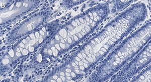 Anti-HCF-1 Antibody, clone 1B17 ZooMAb&#174; Rabbit Monoclonal recombinant, expressed in HEK 293 cells