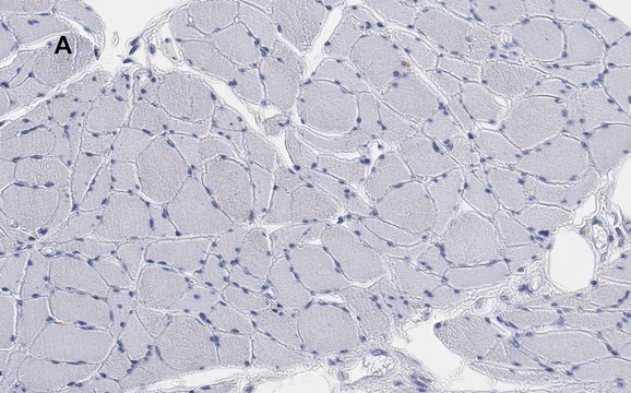 Anti-Desmin Antibody, clone 1H16, ZooMAb&#174; Rabbit Monoclonal recombinant, expressed in HEK 293 cells