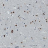 Monoclonal Anti-SATB2 antibody produced in mouse Prestige Antibodies&#174; Powered by Atlas Antibodies, clone CL0323, purified immunoglobulin, buffered aqueous glycerol solution