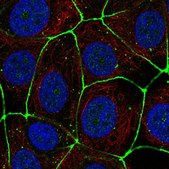 Anti-CLDN3 antibody produced in rabbit Prestige Antibodies&#174; Powered by Atlas Antibodies, affinity isolated antibody, buffered aqueous glycerol solution