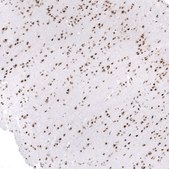 Monoclonal Anti-Smarcb1 Antibody Produced In Mouse Prestige Antibodies&#174; Powered by Atlas Antibodies, clone CL14031, affinity isolated antibody, buffered aqueous glycerol solution