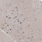 Anti-FOXO1 antibody produced in rabbit Prestige Antibodies&#174; Powered by Atlas Antibodies, affinity isolated antibody, buffered aqueous glycerol solution