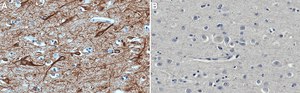 Anti-MAP2 Antibody, clone 5F9 clone 5F9, Upstate&#174;, from mouse