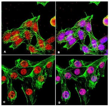 Anti-ATM Antibody Upstate&#174;, from rabbit