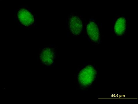 Anti-STAT6 antibody produced in mouse purified immunoglobulin, buffered aqueous solution