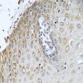 Anti-POR antibody produced in rabbit