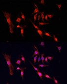 Anti- EGFR antibody produced in rabbit