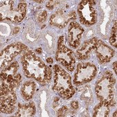 Anti-ARSB antibody produced in rabbit Prestige Antibodies&#174; Powered by Atlas Antibodies, affinity isolated antibody, buffered aqueous glycerol solution