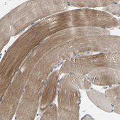 Anti-TRAK1 antibody produced in rabbit Prestige Antibodies&#174; Powered by Atlas Antibodies, affinity isolated antibody, buffered aqueous glycerol solution