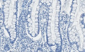 Anti-RIP1/RIPK1 Antibody, clone 1N16 ZooMAb&#174; Rabbit Monoclonal recombinant, expressed in HEK 293 cells