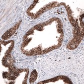 Monoclonal Anti-Adam10 Antibody Produced In Mouse Prestige Antibodies&#174; Powered by Atlas Antibodies, clone CL13808, affinity isolated antibody, buffered aqueous glycerol solution