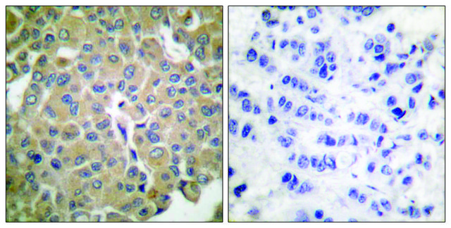 Anti-MART-1 antibody produced in rabbit affinity isolated antibody