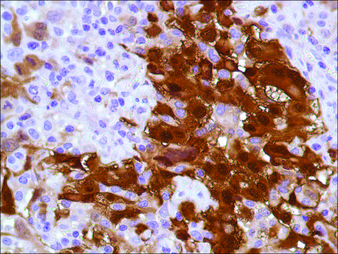 Anti-Calretinin antibody, Rabbit monoclonal clone SP13, recombinant, expressed in proprietary host, tissue culture supernatant