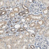 Anti-ASAH1 antibody produced in rabbit Prestige Antibodies&#174; Powered by Atlas Antibodies, affinity isolated antibody, buffered aqueous glycerol solution