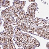 Anti-SERPINE1 antibody produced in rabbit Prestige Antibodies&#174; Powered by Atlas Antibodies, affinity isolated antibody, buffered aqueous glycerol solution