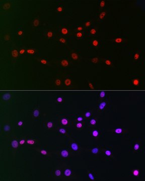 Anti-CTBP2 Antibody, clone 1R1U6, Rabbit Monoclonal