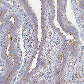 Anti-ALKBH8 antibody produced in rabbit Prestige Antibodies&#174; Powered by Atlas Antibodies, affinity isolated antibody, buffered aqueous glycerol solution