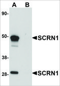Anti-SCRN1 antibody produced in rabbit affinity isolated antibody, buffered aqueous solution