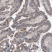 Anti-UPF1 antibody produced in rabbit affinity isolated antibody, buffered aqueous glycerol solution, Ab1