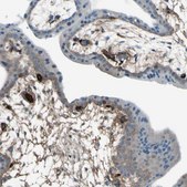 Anti-AFP antibody produced in rabbit Prestige Antibodies&#174; Powered by Atlas Antibodies, affinity isolated antibody, buffered aqueous glycerol solution