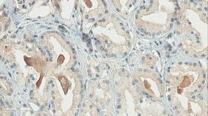 Anti-Gonadotropin-Releasing Hormone Antibody, NT, clone HU11B (Ascites Free) clone HU11B, from mouse