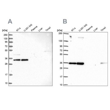 Anti-NOSIP antibody produced in rabbit Prestige Antibodies&#174; Powered by Atlas Antibodies, affinity isolated antibody, buffered aqueous glycerol solution