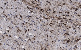Anti-GFAP Antibody, clone 2E8, ZooMAb&#174; Rabbit Monoclonal recombinant, expressed in HEK 293 cells