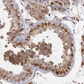 Anti-RNF139 antibody produced in rabbit Prestige Antibodies&#174; Powered by Atlas Antibodies, affinity isolated antibody, buffered aqueous glycerol solution