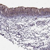 Anti-SPAG17 antibody produced in rabbit Prestige Antibodies&#174; Powered by Atlas Antibodies, affinity isolated antibody, buffered aqueous glycerol solution, ab1
